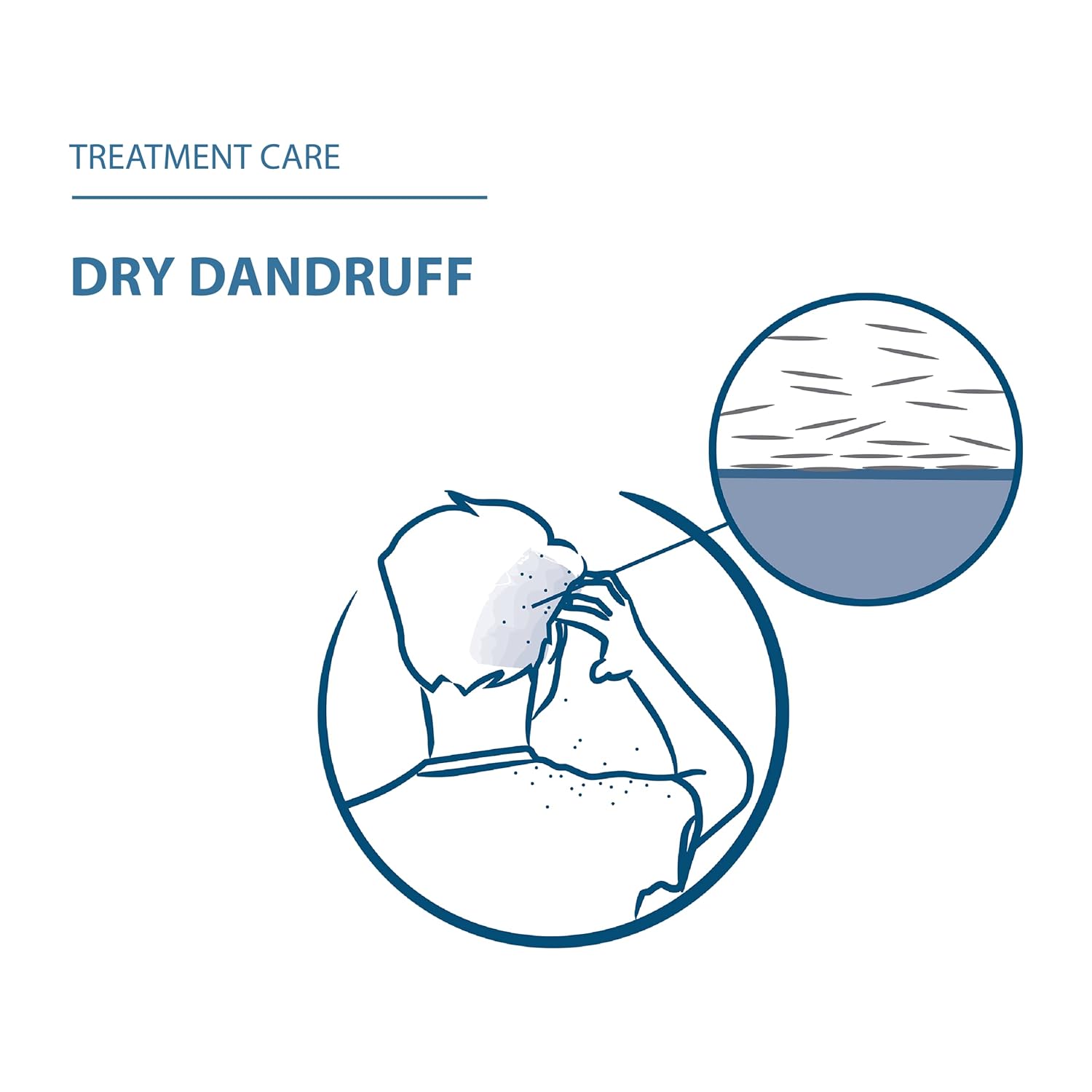 Ducray Squanorm Dry Dandruff Shampoo 200 ml