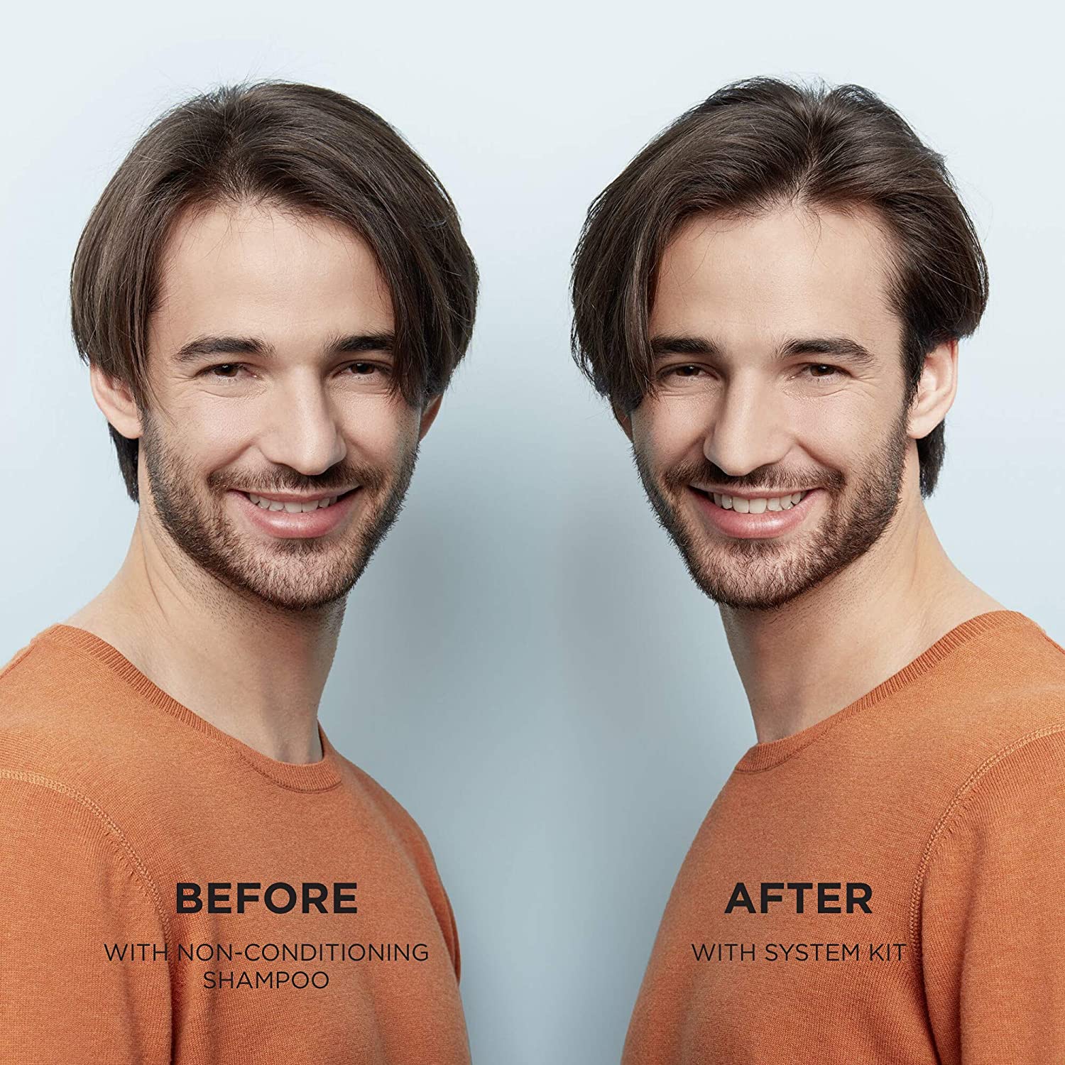 Nioxin System 2 Scalp Therapy Conditioner with Peppermint Oil, Treats Dry Scalp, Provides Moisture Control & Balance, For Natural Hair with Progressed Thinning, 33.8 fl oz